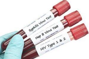 test-tubes-of-blood-with-std-test-labels