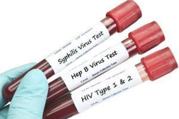 test-tubes-of-blood-with-std-test-labels